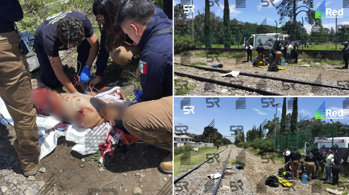 ACTUALIZACIÓN: Víctima arrollada por tren en Amalucan sobrevive con amputaciones y lesiones graves